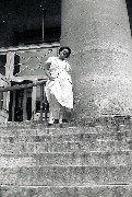 Joy Sayger showing her leg 1948